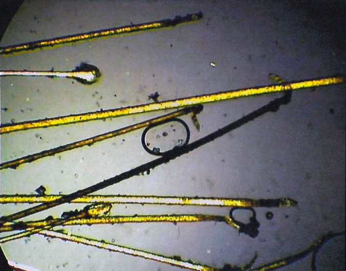 Haarwortels onder de microscoop. Voor de specialist zijn problemen zo duidelijk te herkennen.